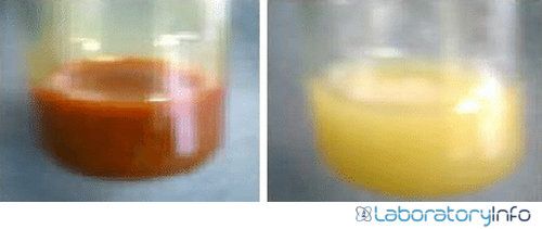 Figura: ensayo de Mayer La formación de precipitados de color crema o blanquecino indica a la derecha un resultado positivo. La imagen de la izquierda muestra un resultado negativo.