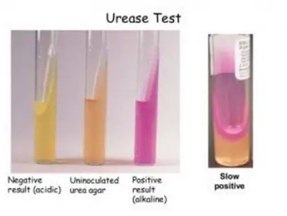 Cuatro tubos de ensayo de prueba de ureasa con diferentes grados de resultados