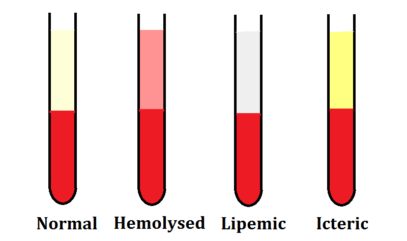 Muestras Hemolizadas-Lipémicas-Ictéricas