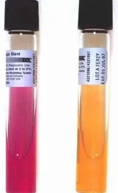 Dos tubos de ensayo para la prueba de ureasa; el tubo de ensayo rosa es positivo para ureasa, mientras que el tubo de ensayo naranja es negativo