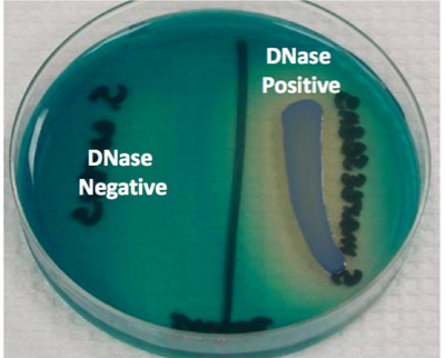 el lado izquierdo de la placa es negativo, mientras que el lado derecho es positivo para la prueba de ADNasa