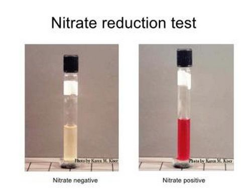 uno es positivo en la prueba de reducción de nitrato y el otro es negativo en la prueba de reducción de nitrato
